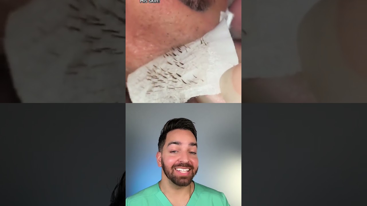 Black dots on the nose? WHAT ARE THOSE! | Doctorly Reacts #shorts