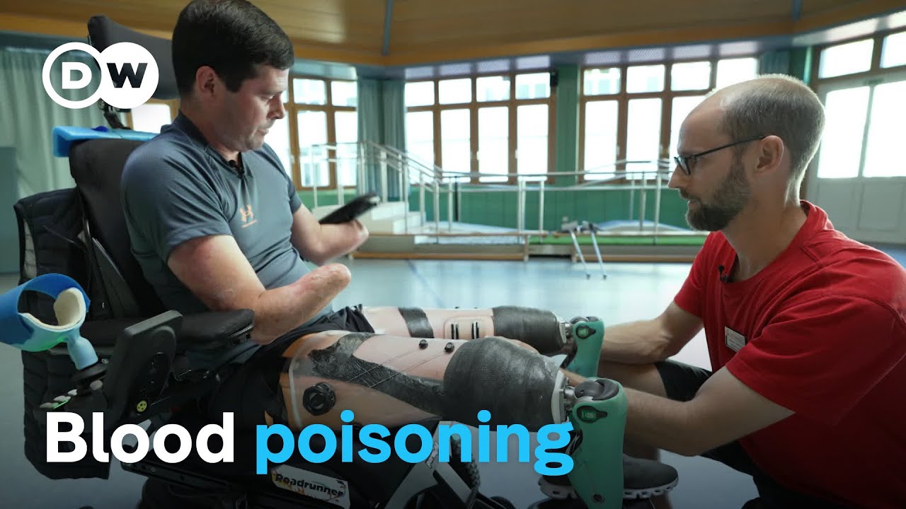 Losing limbs to sepsis | DW Documentary