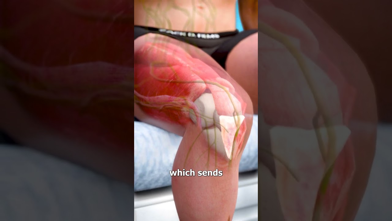 Why Does Your Knee Jerk When Tapped? 🤔