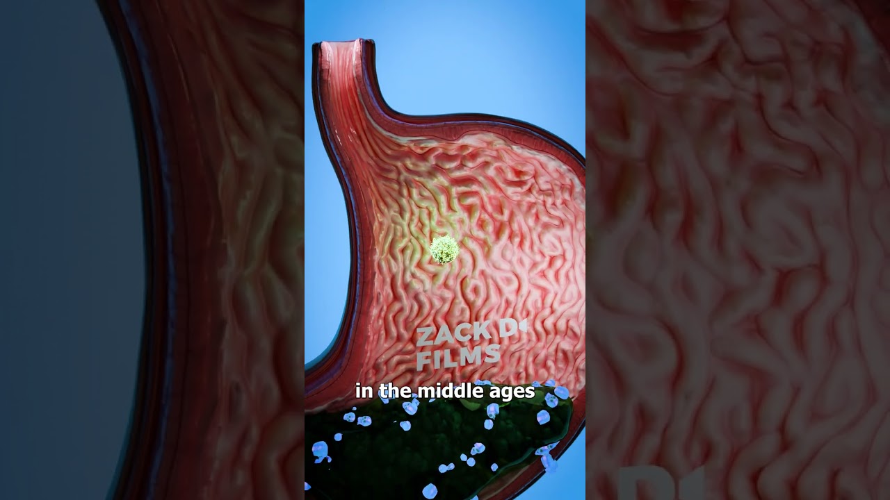 Why Hair Stones Were Used As Medicine 🤢