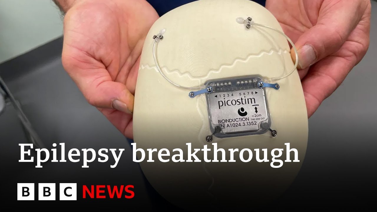 World’s first epilepsy device fitted in boy’s skull | BBC News
