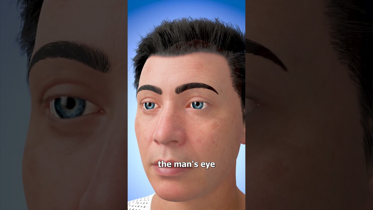 How Eye Transplants Work 👁️