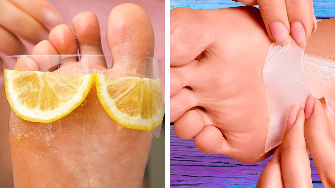 Simple hacks for your shoes and feet!