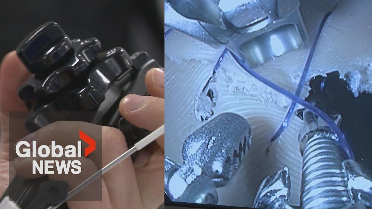 Vancouver doctor 1st in Canada to use new internal suturing device