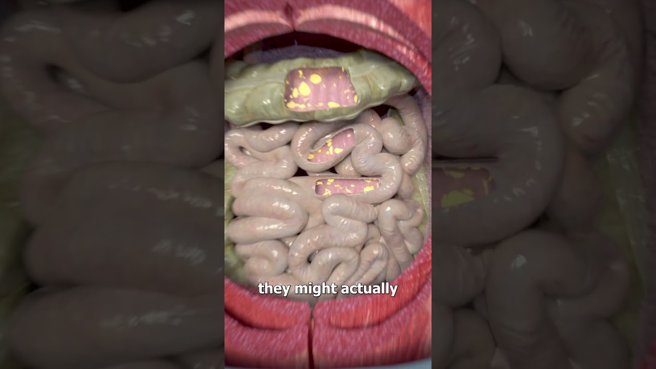 What Is A Rope Worm? 🤔