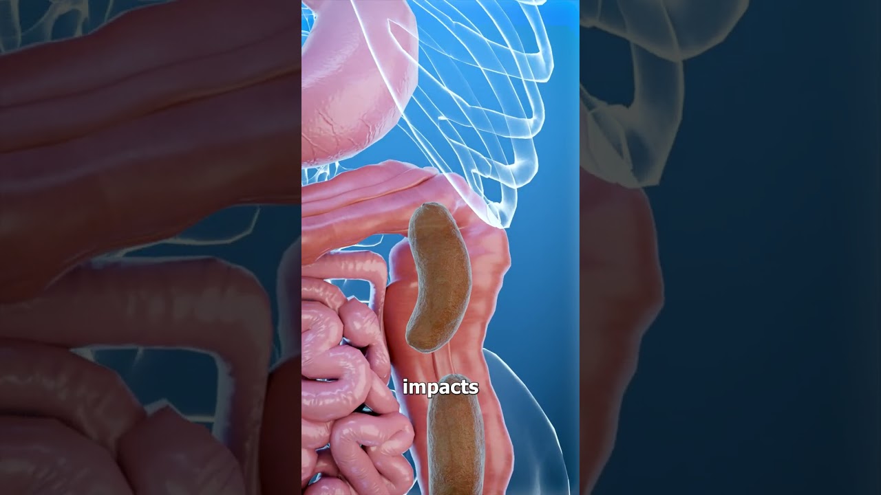 What Is Constipation? 💩