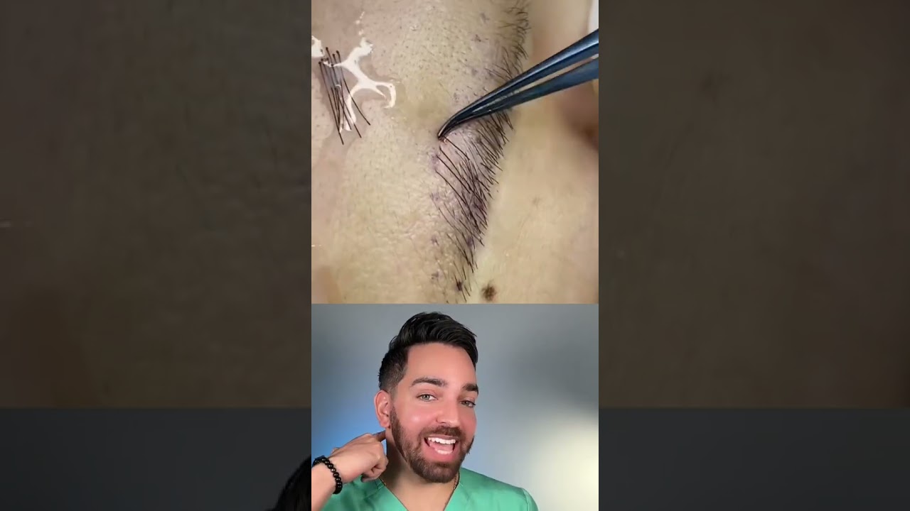 What on Earth Is This? Rare Find on Social Media| Doctorly Explains #shorts