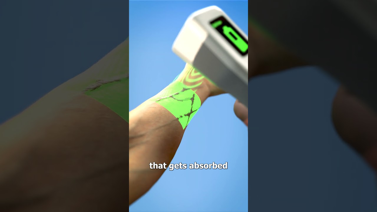 Finding Veins for IVs 🤨