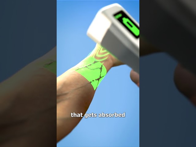 Finding Veins For IVs 😲