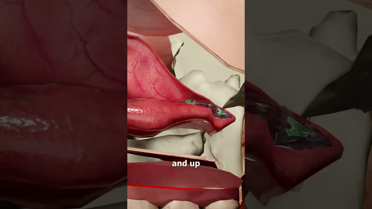 How To Flush Snot Out Of Your Nose 🤧