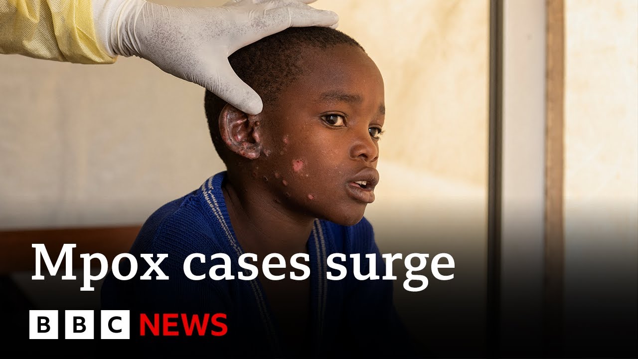 Mpox vaccinations are set to begin as cases surge | BBC News