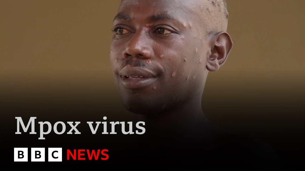 New strain of Mpox spreading rapidly in central Africa | BBC News