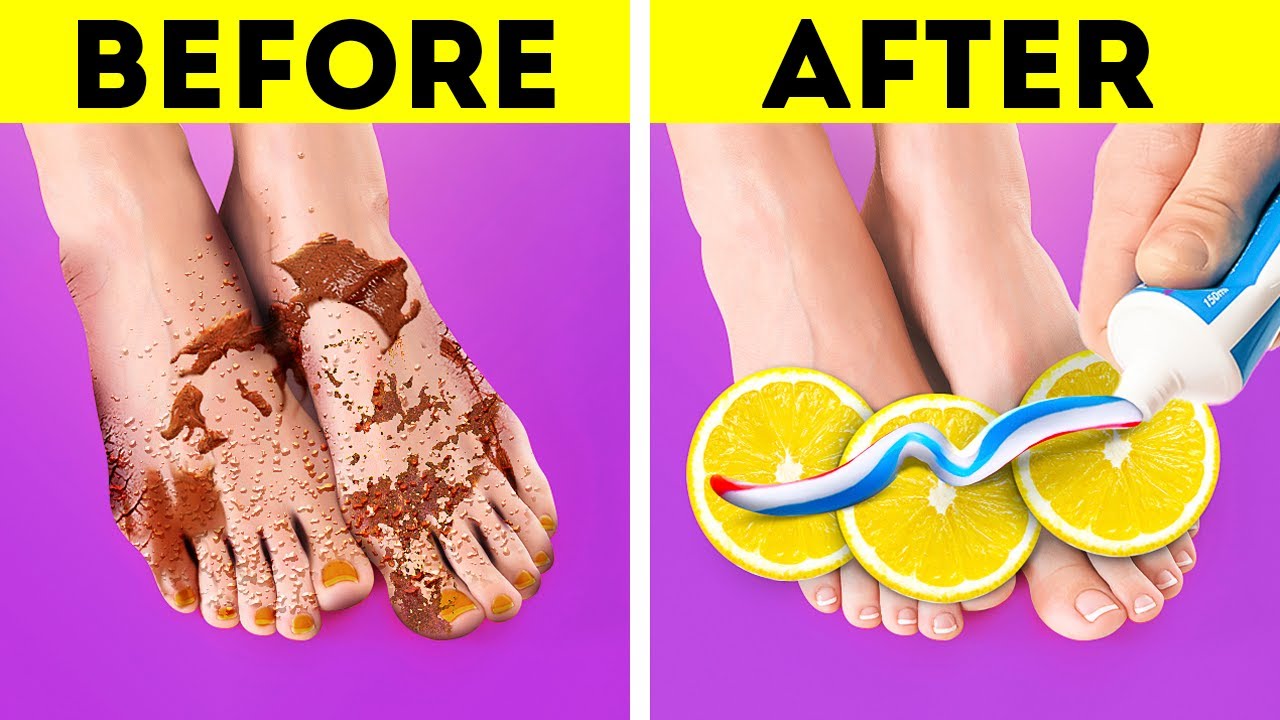 Simple pedicure and feet hacks you should know about