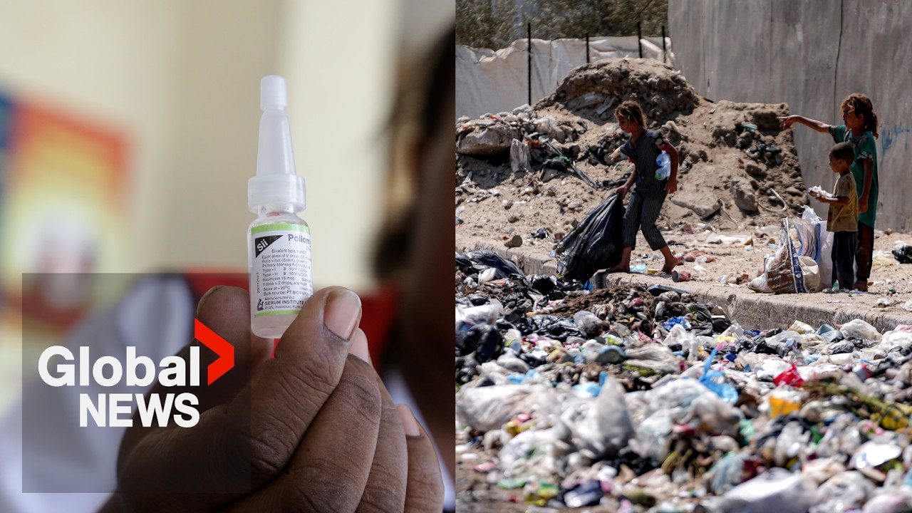 UNRWA launches polio vaccine campaign in Gaza after 1st case in 25 years
