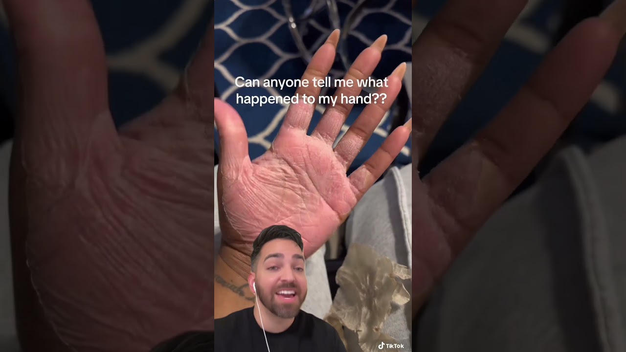 Whatttttttt?│Doctorly #shorts