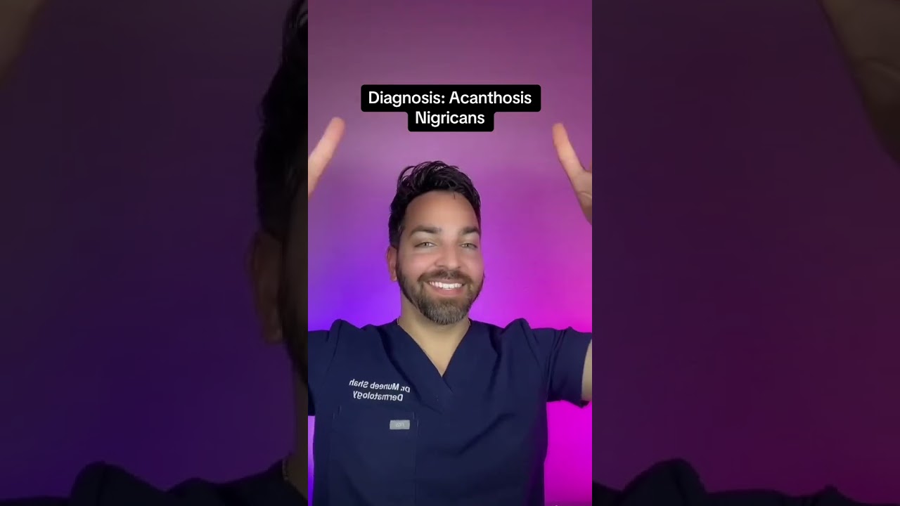 Do you have darker neck? This is acanthosis nigricans… you’re not dirty!