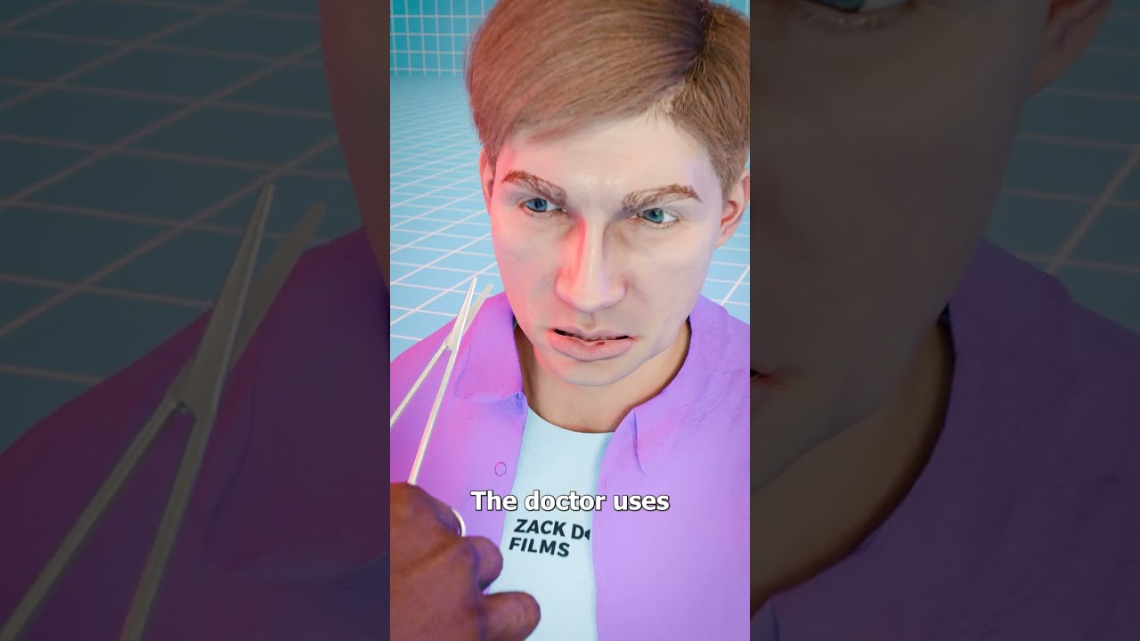 How Tongue-Tie Is Fixed 😮