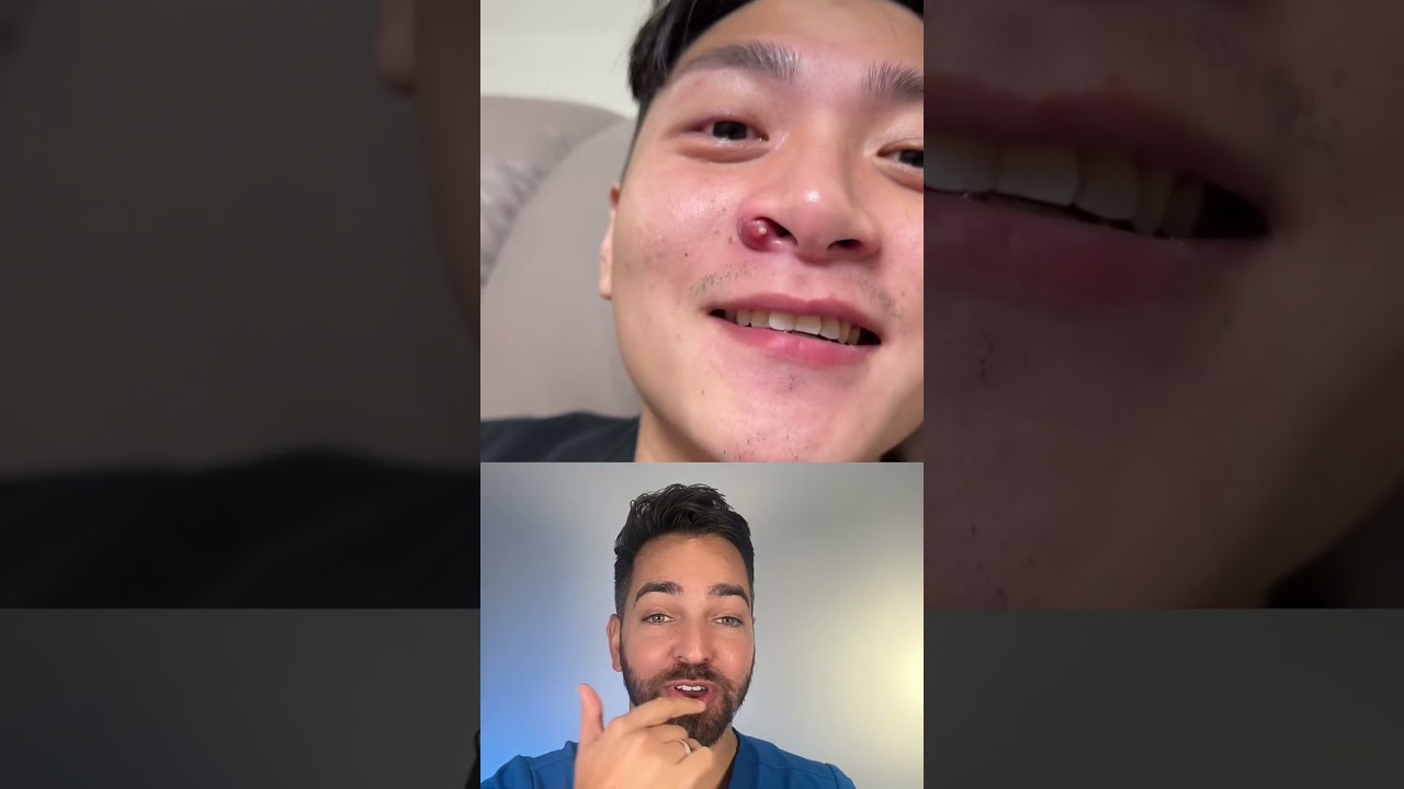 Triangle of DEATH | Doctorly #shorts