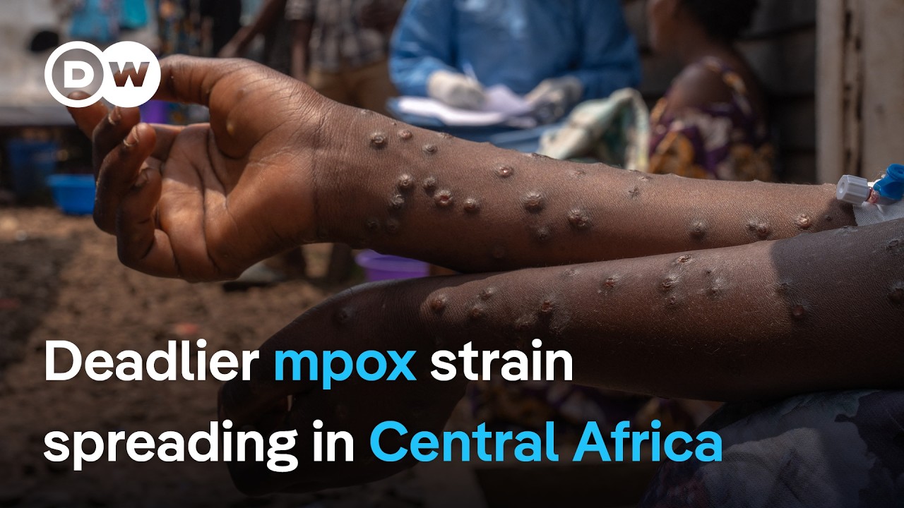 With deadlier mpox strain spreading in Central Africa, what’s holding up vaccinations ? | DW News