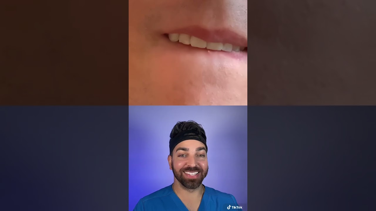 You Won’t Know How to React to This Pimple Pop… │ Doctorly Reacts