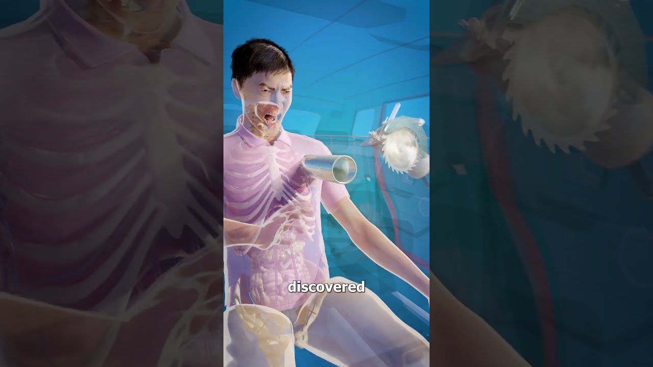 Guard Rail Impales Man 😵