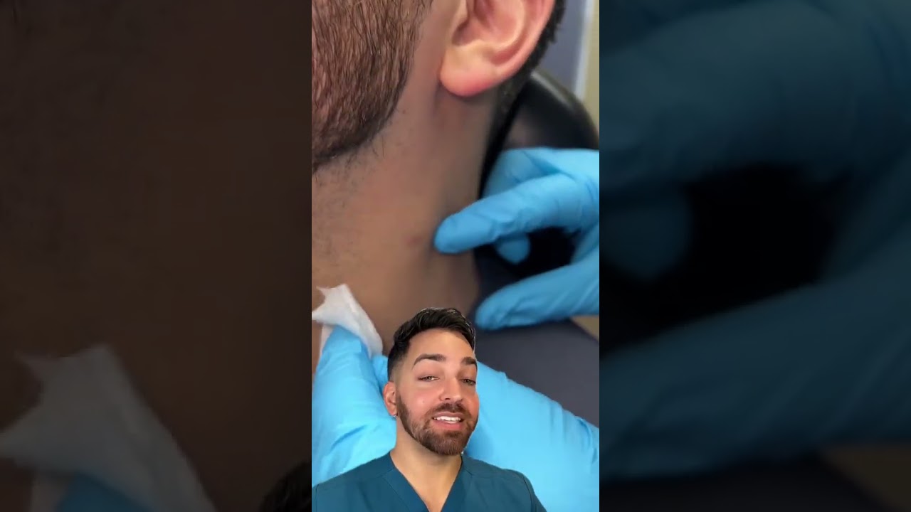 Skin Tag! Doctorly | #shorts