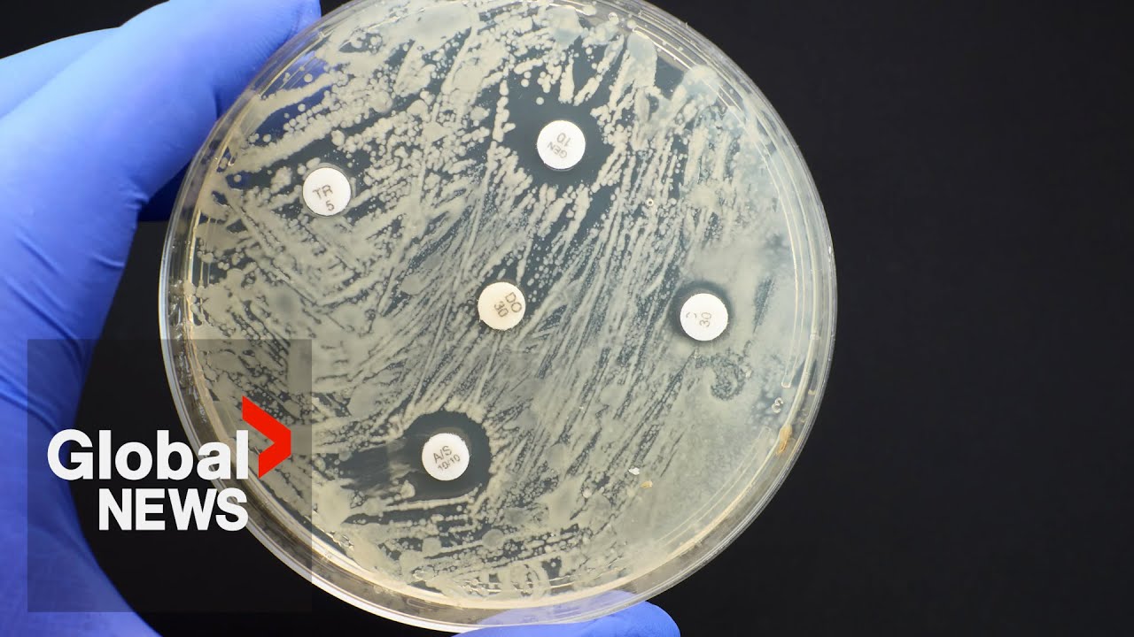 “Superbugs” could be treated by computer-designed antibiotics, scientists say