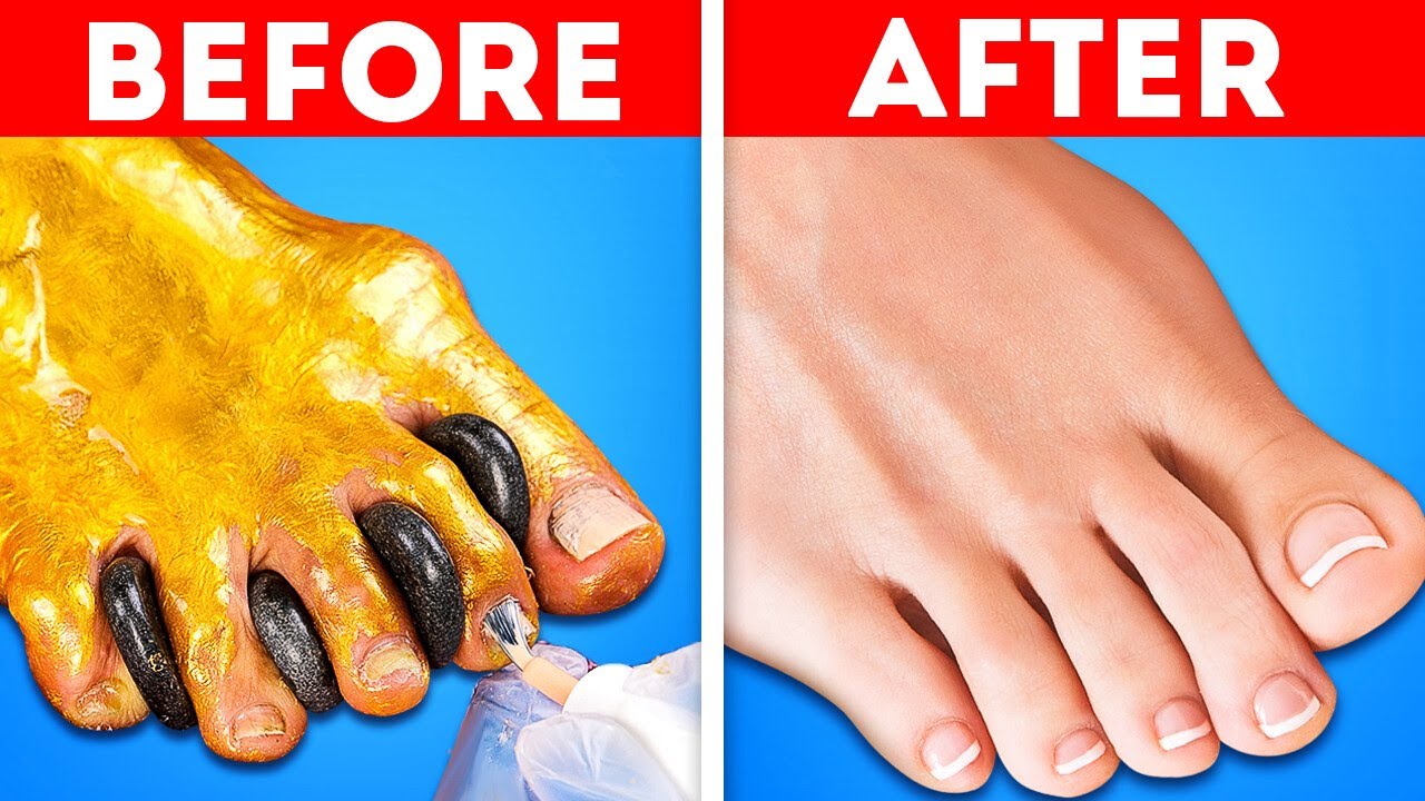 Time for At-Home Foot Therapy Hacks! 🦶 Natural & Affordable Tips for Healthy, Happy Feet