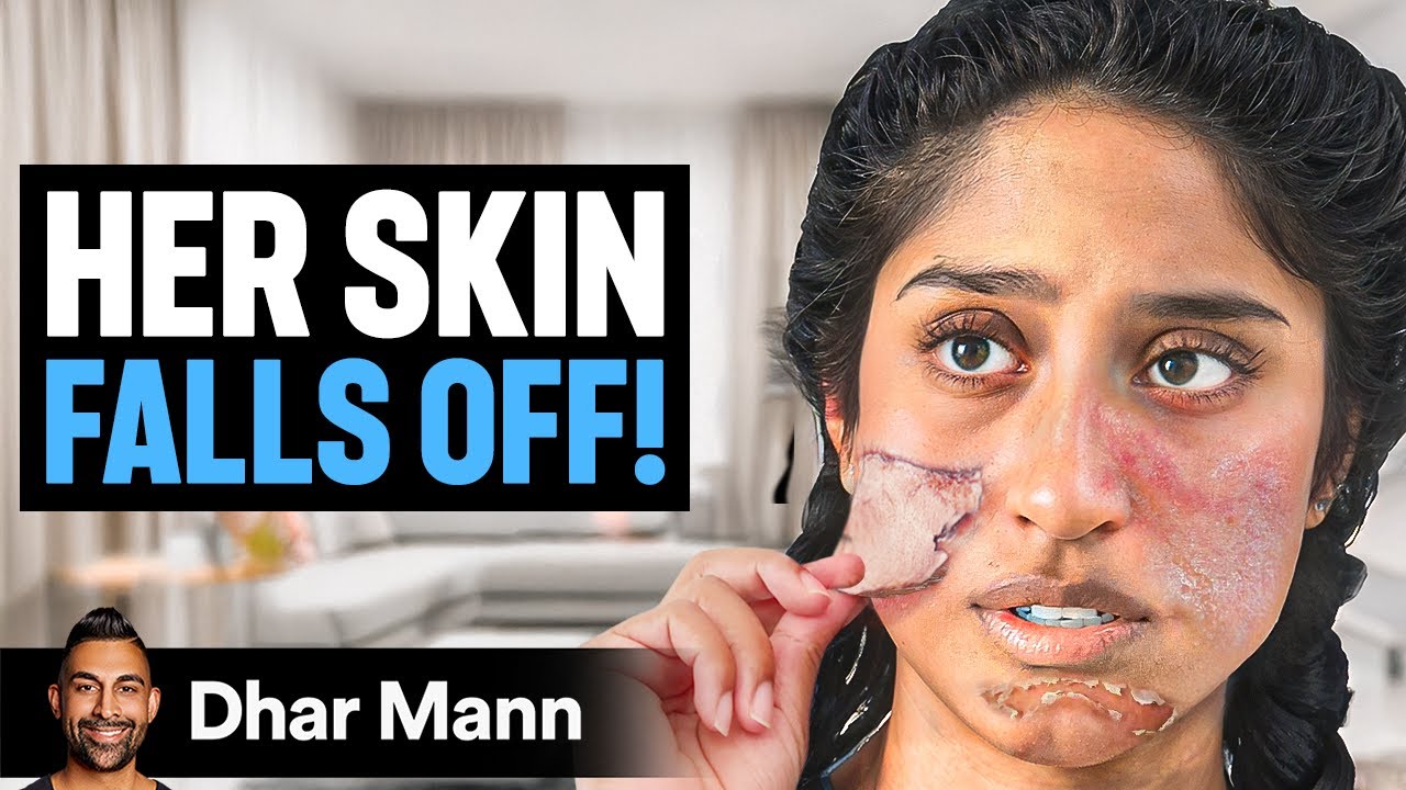 Girl Whose SKIN FALLS OFF! | Dhar Mann Studios