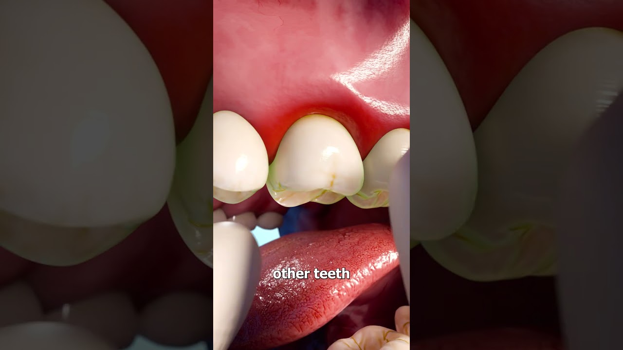 How Dentists Reinsert A Tooth 🤔