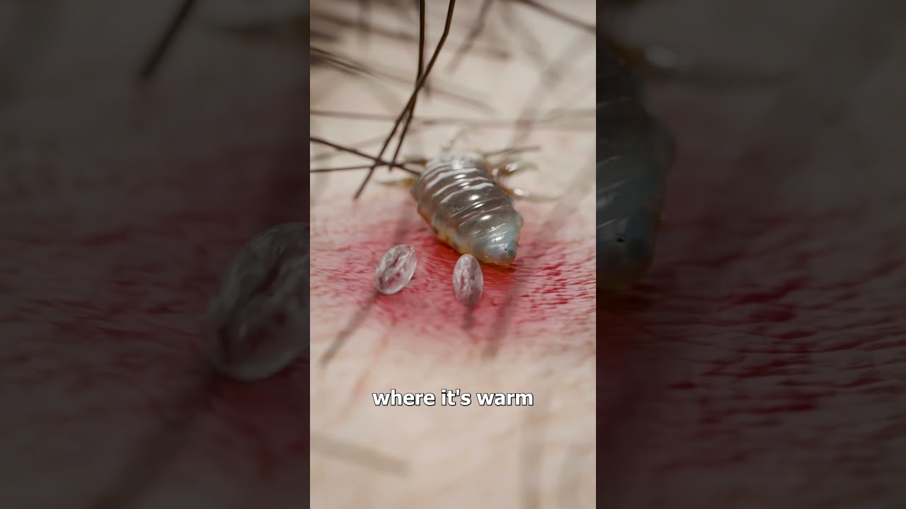 How Lice Survive On Your Scalp 😳