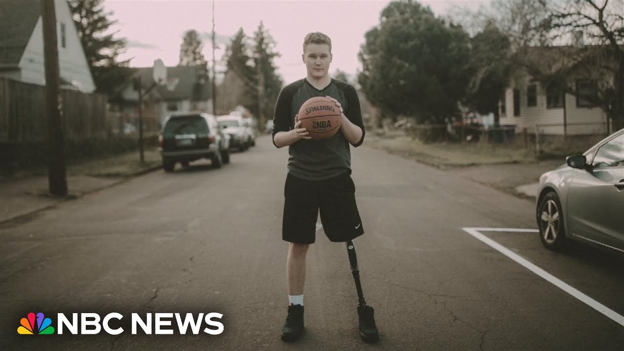 Oregon teen hopes for return of stolen prosthetic leg