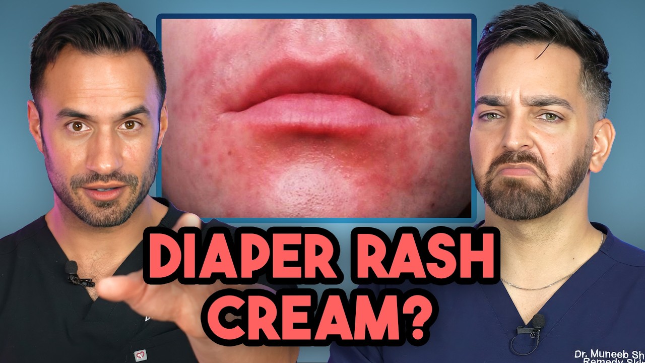 Red Rash Around the Mouth? How to Treat and Prevent Perioral Dermatitis