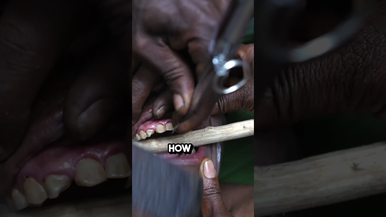 Tooth Sharpening with the Baka Tribe