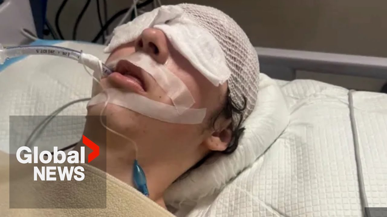 Alberta teen in coma after alleged assault at resort in Dominican Republic