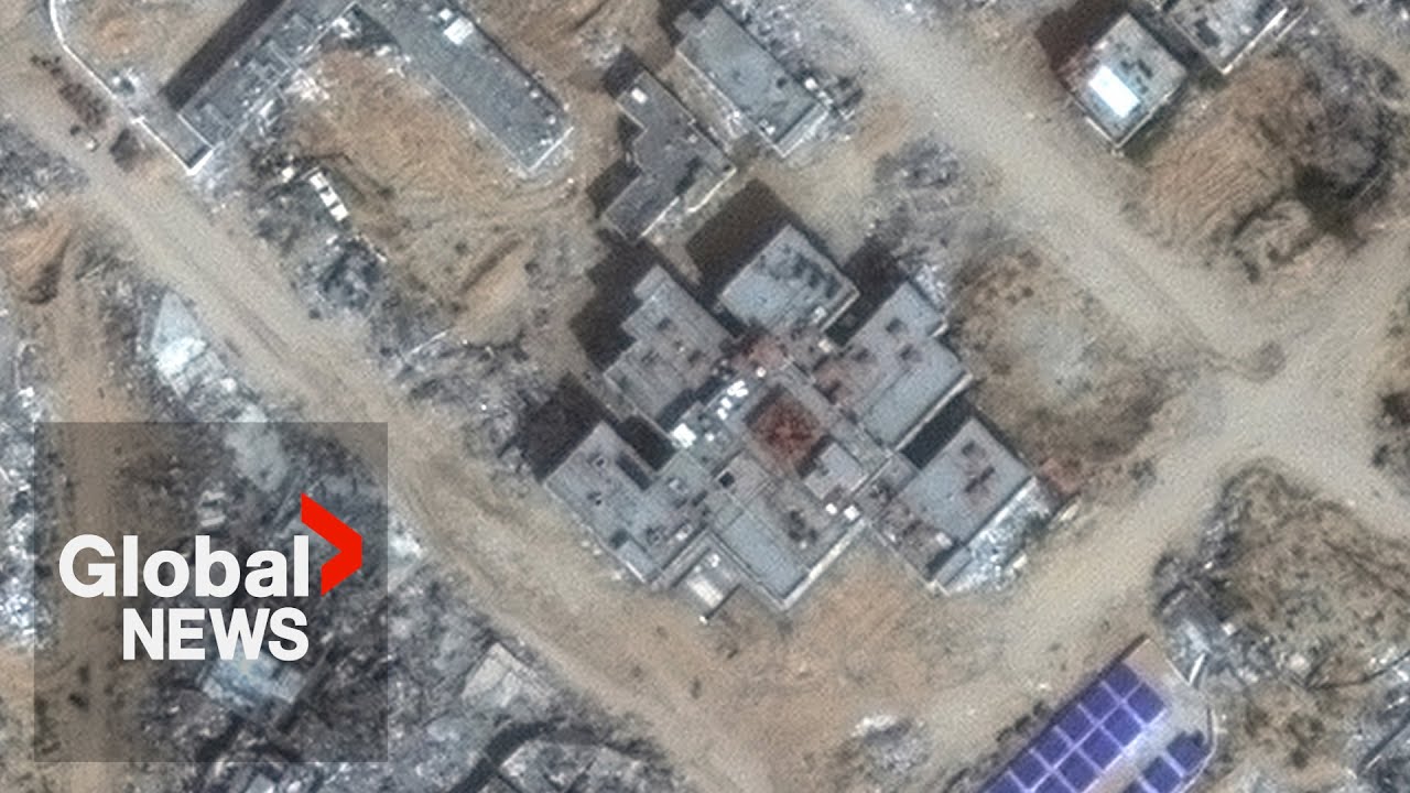 UN report slams regular Israeli attacks on Gaza hospitals