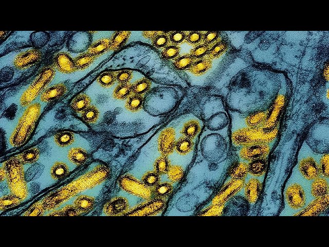 WHO says risk of bird flu ‘still low’ after US reports its first human death