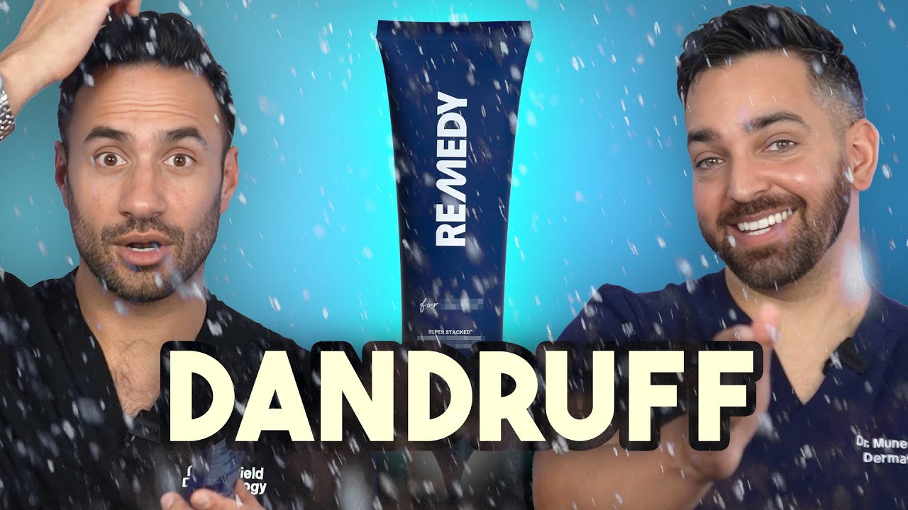 Dandruff? Flaky scalp? INTRODUCING OUR REMEDY FOR DANDRUFF!
