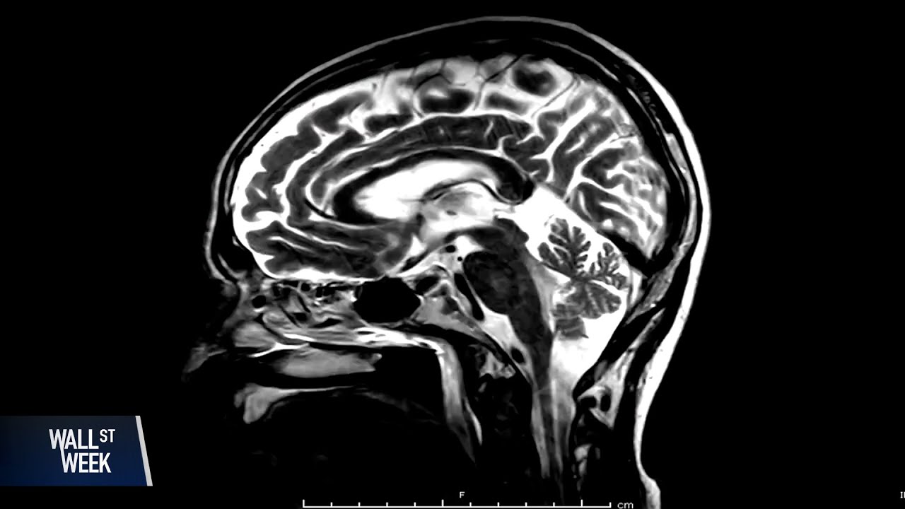 The Reality of Alzheimer’s Research