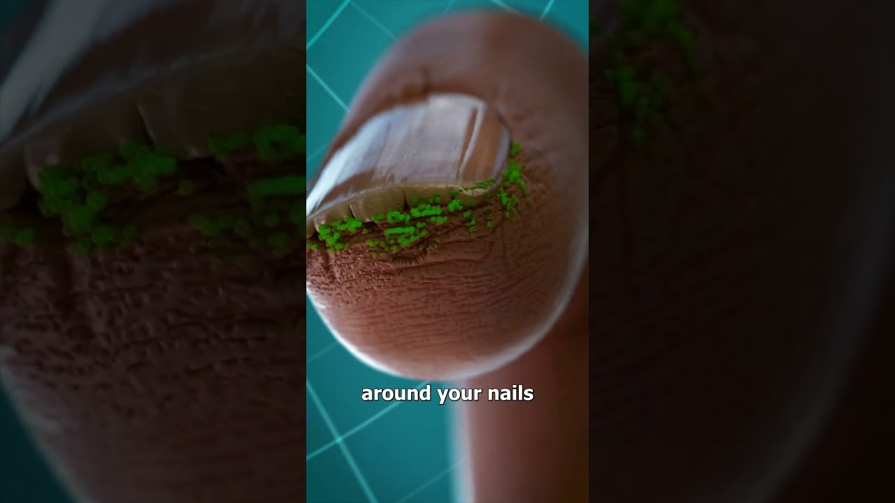 Why You Shouldn’t Bite Your Nails 😖