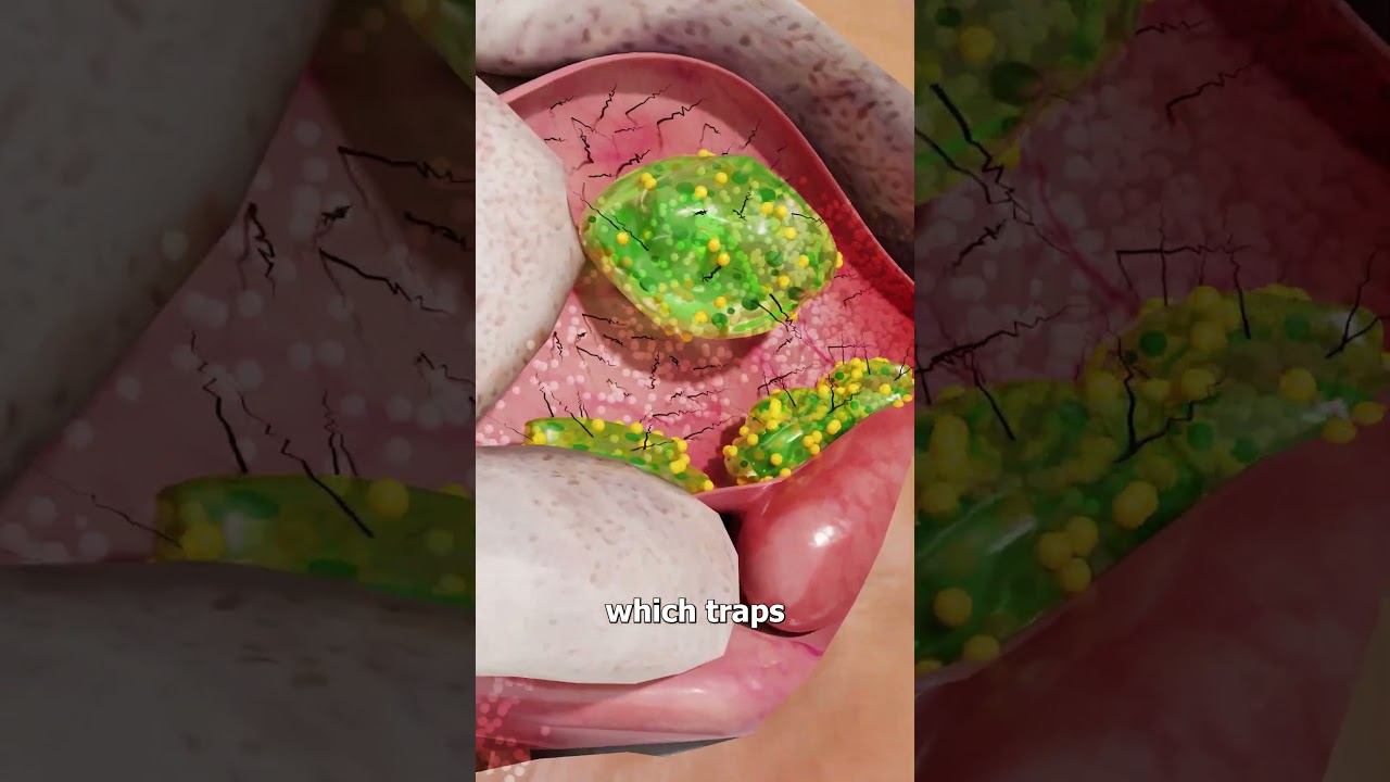 Why You Shouldn’t Eat Your Boogers 🤢