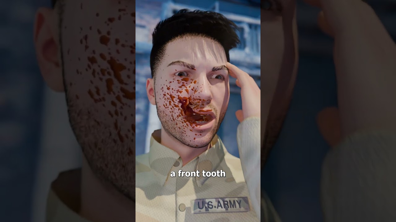A Bullet Stopped By A Tooth 😱