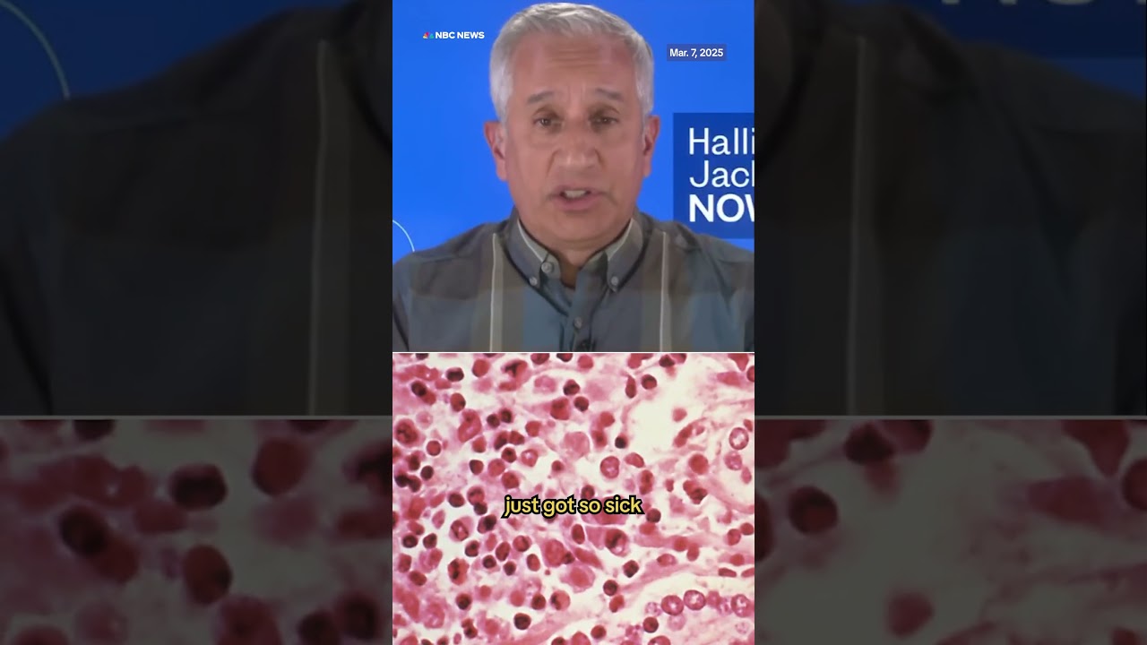 Doctor explains hantavirus after Gene Hackman and wife’s death