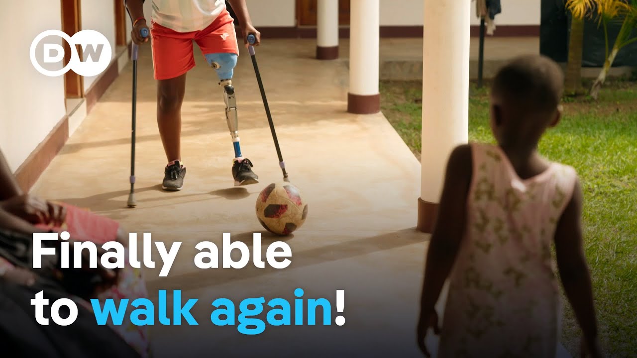 Uganda – Protheses for a new life | DW Documentary