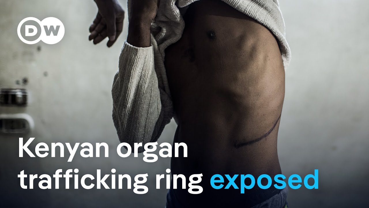 Kenya halts kidney transplants  after DW investigation | DW News