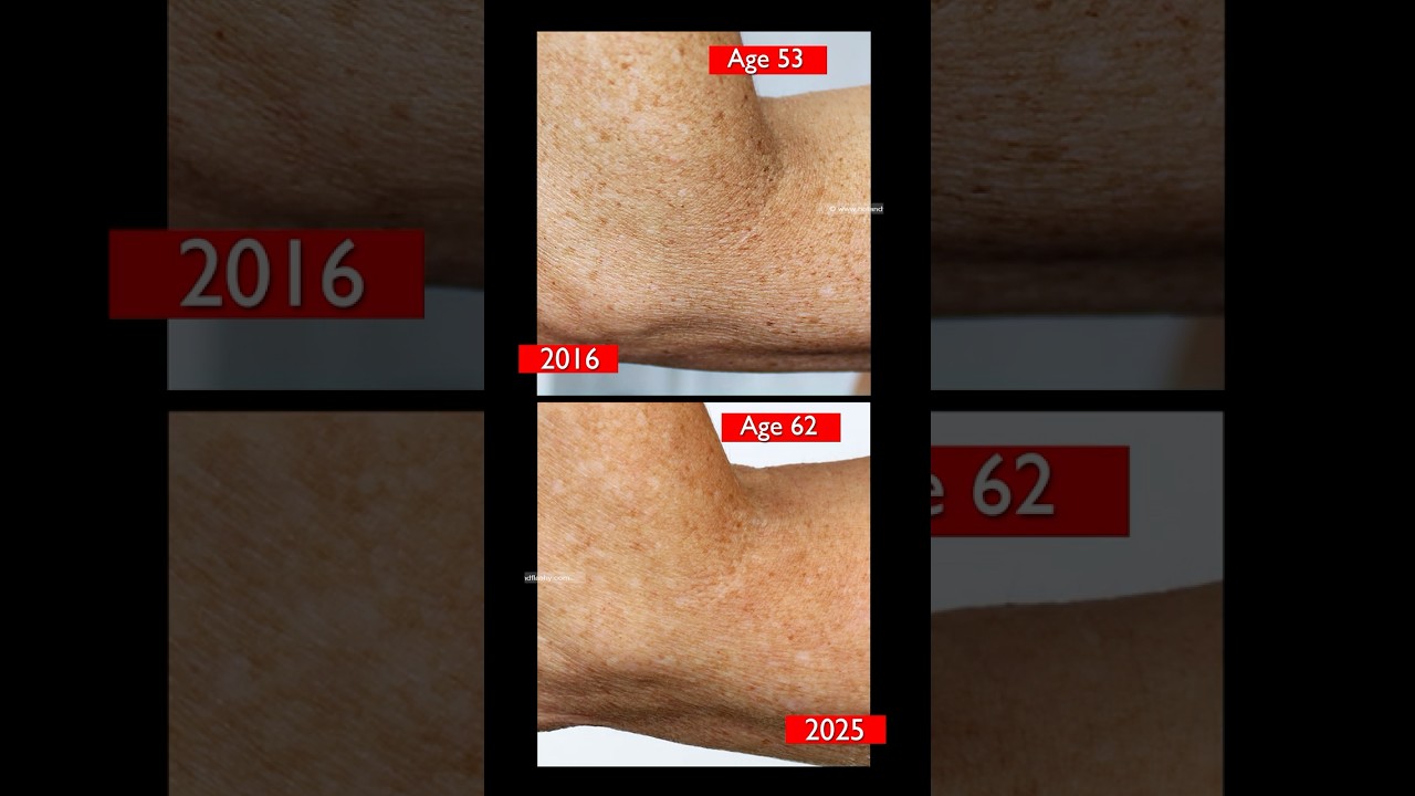 BEST Skincare for CREPEY Body Skin! #skincare #over40skincare  #crepeyskinfix