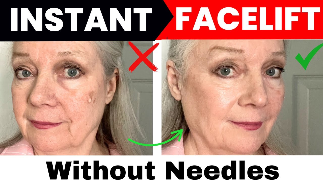 Facelift Without Needles Or Surgery Women Over 50 & 60