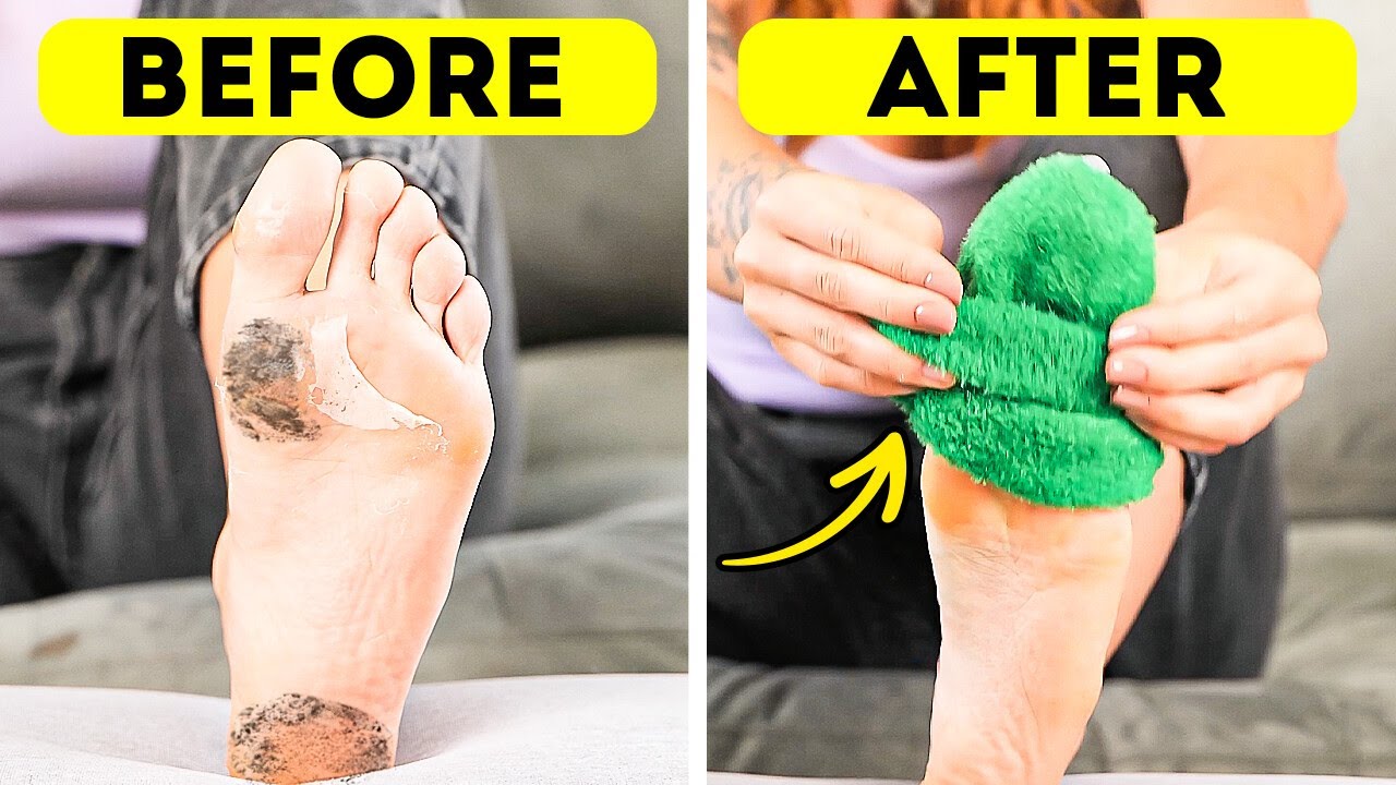 Feet Ready for Summer? Try These Easy Glow-Up Hacks! 💅👡 #footcare