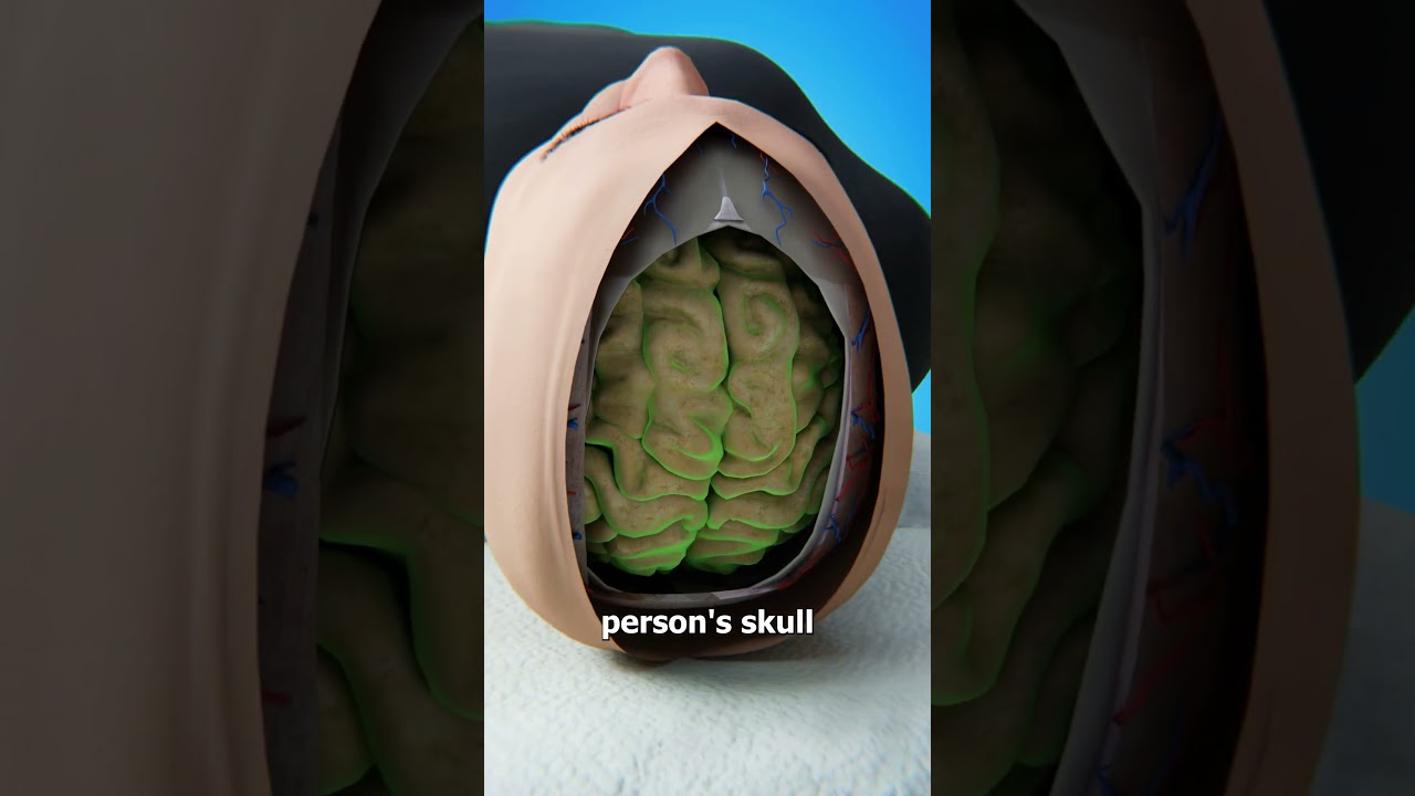 Is It Possible To Swap Brains? 🤔