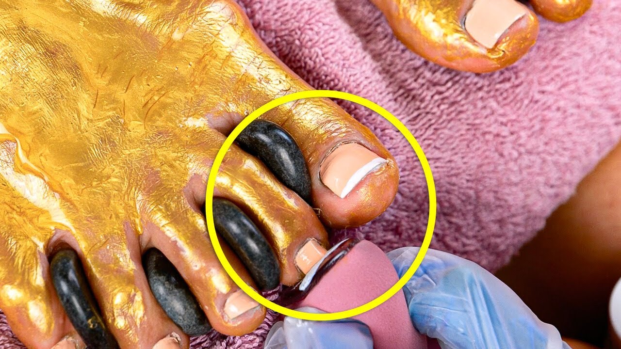 Say Goodbye to Dry Feet! 💧✨ Summer Foot Hacks You Need #beautyhacks